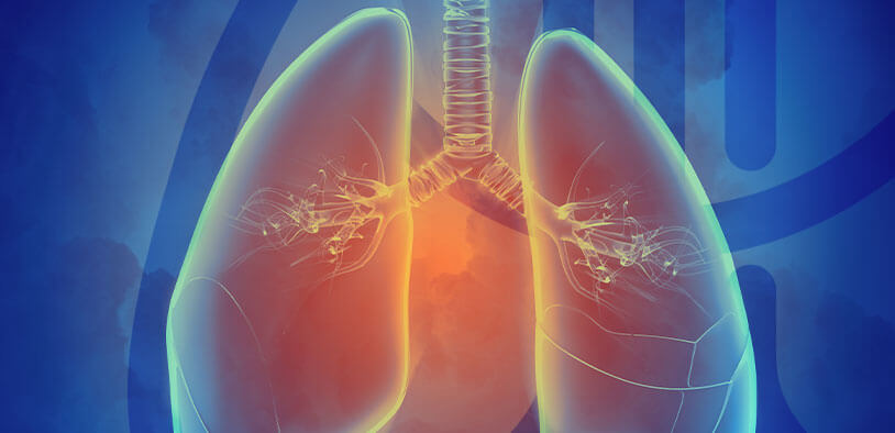 Imagem Doença Pulmonar Obstrutiva Crônica